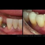 Before & after dental treatment