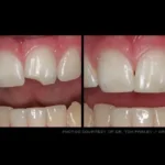 Before & after dental treatment