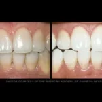 Before & after dental treatment