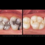 Before & after dental treatment