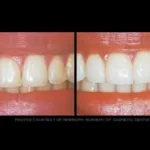 Before & after dental treatment