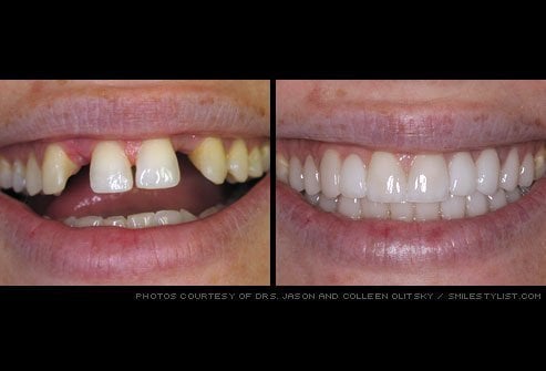 Before & after dental treatment