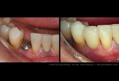 Before & after dental treatment