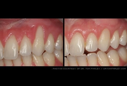 Before & after dental treatment