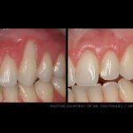 Before & after dental treatment