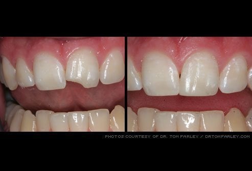 Before & after dental treatment