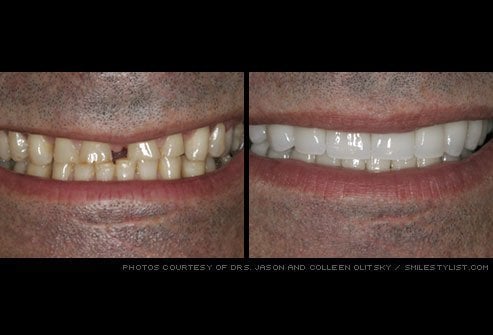 Before & after dental treatment