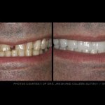 Before & after dental treatment