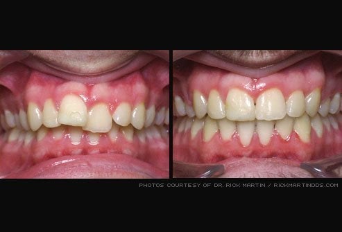 Before & after dental treatment