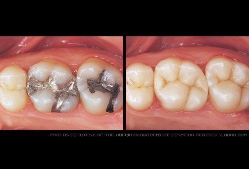 Before & after dental treatment