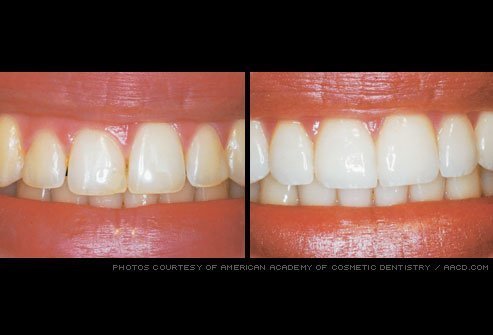 Before & after dental treatment